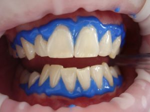 cosmetic dentisrty